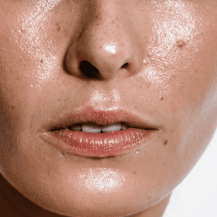 Oil / Acne Control